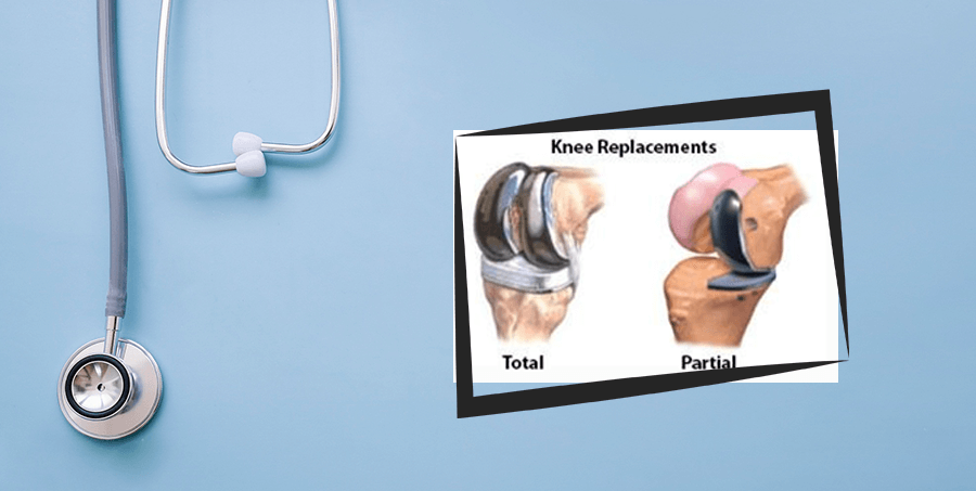 Best knee replacement Surgeon in Ahmedabad